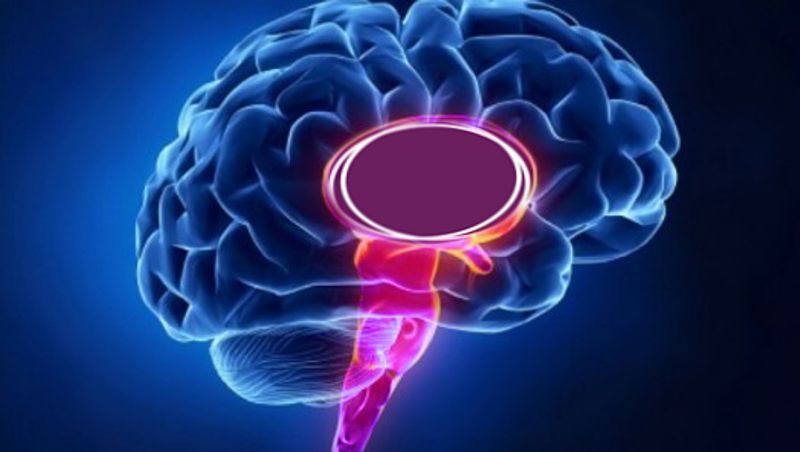 Cerebro podemita