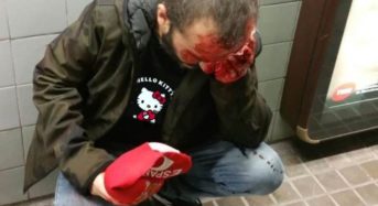 El joven español agredido ayer en Barcelona lucía en realidad una camiseta de «Hello Kitty»