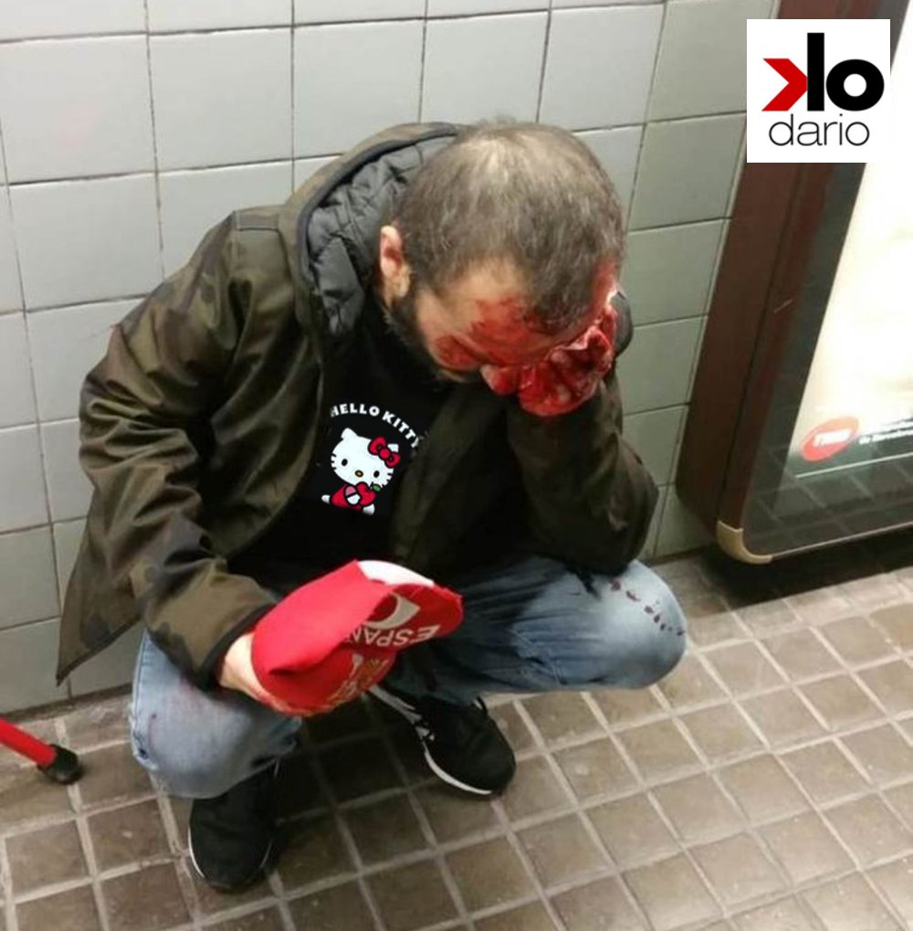 Joven agredido en metro de Barcelona por llevar gorra de España camiseta Hello Kitty